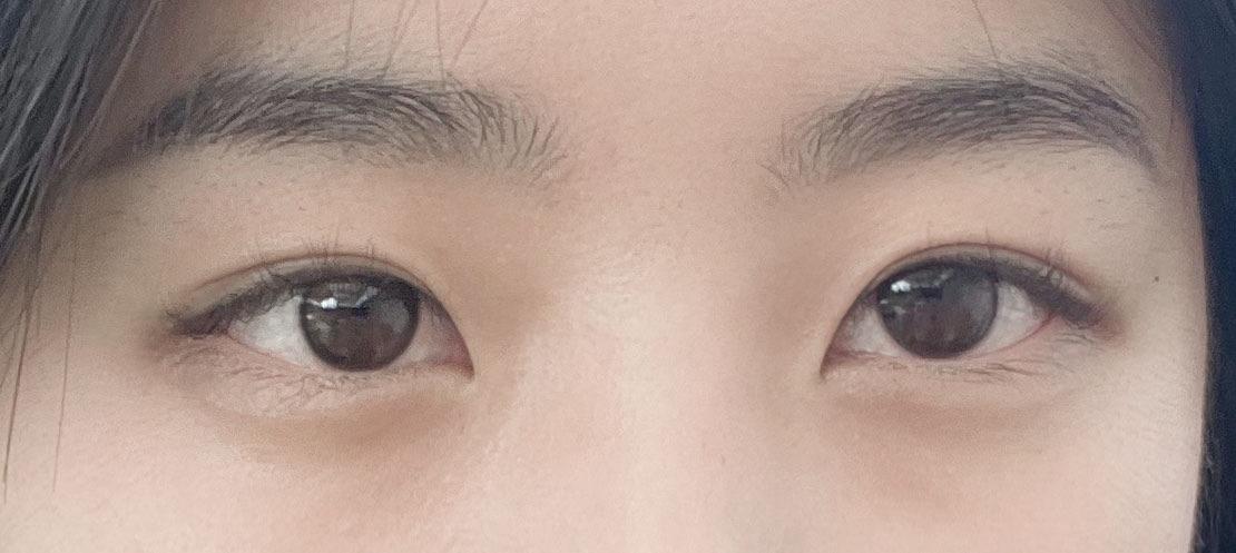 後