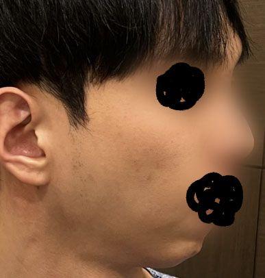 後