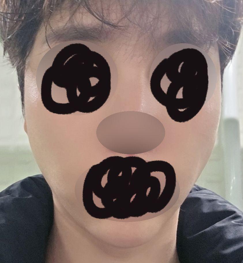 後