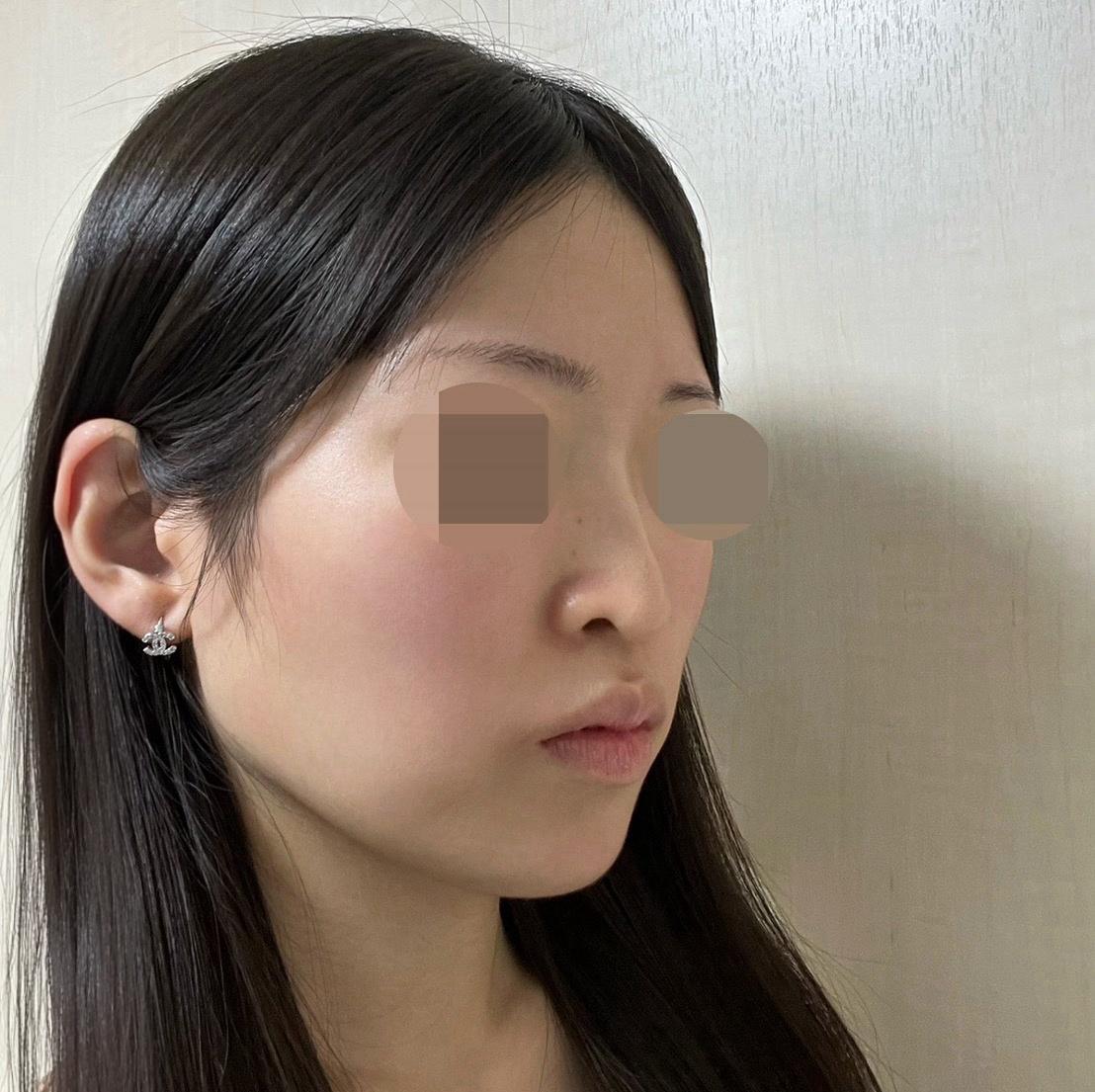 後