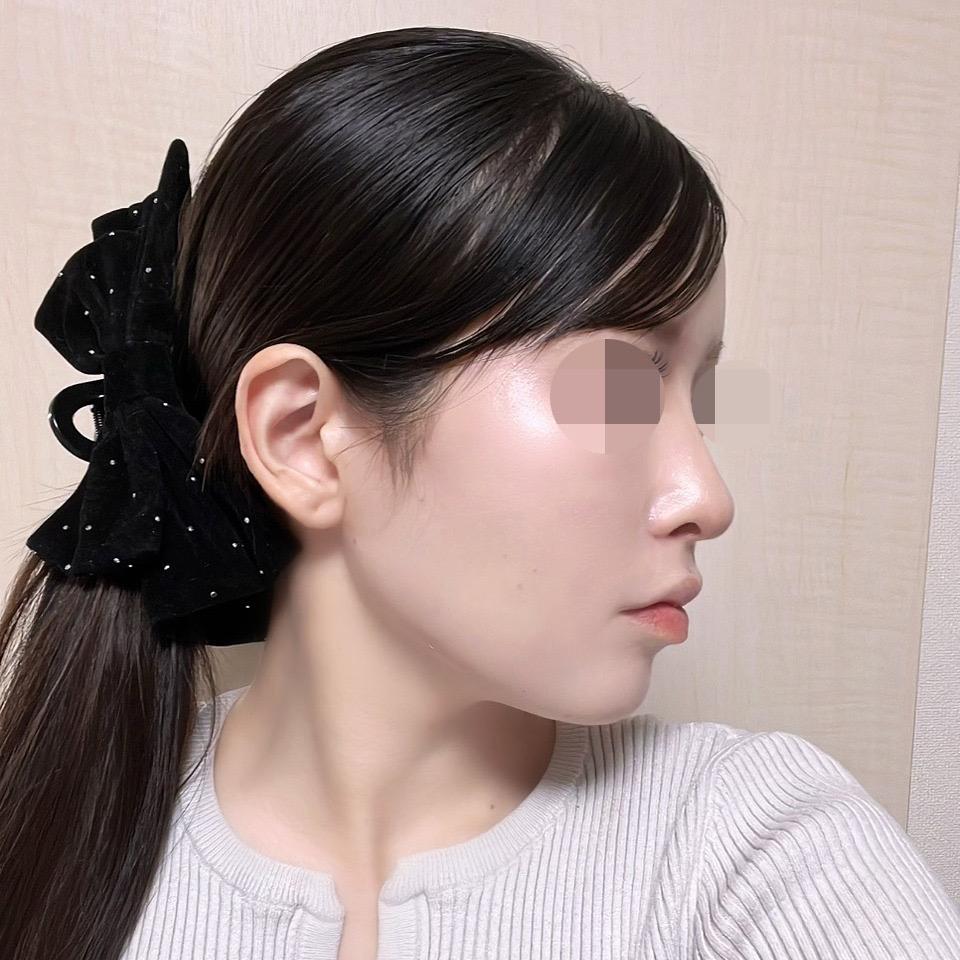 後