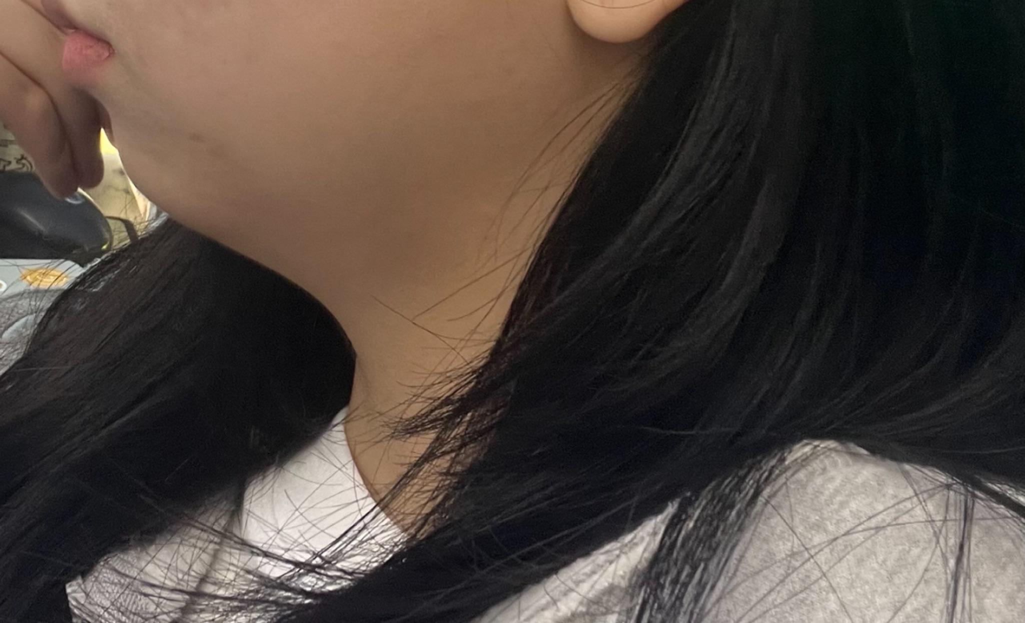 後
