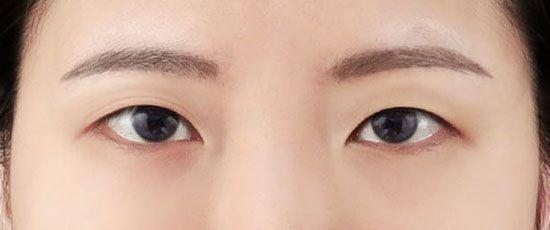 前