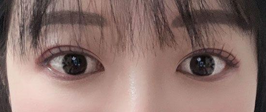 后