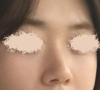 後