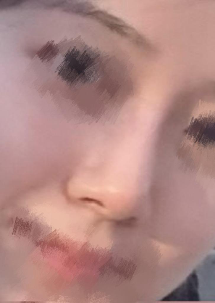 後