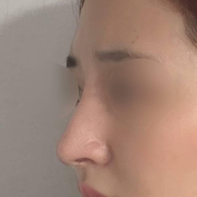 後