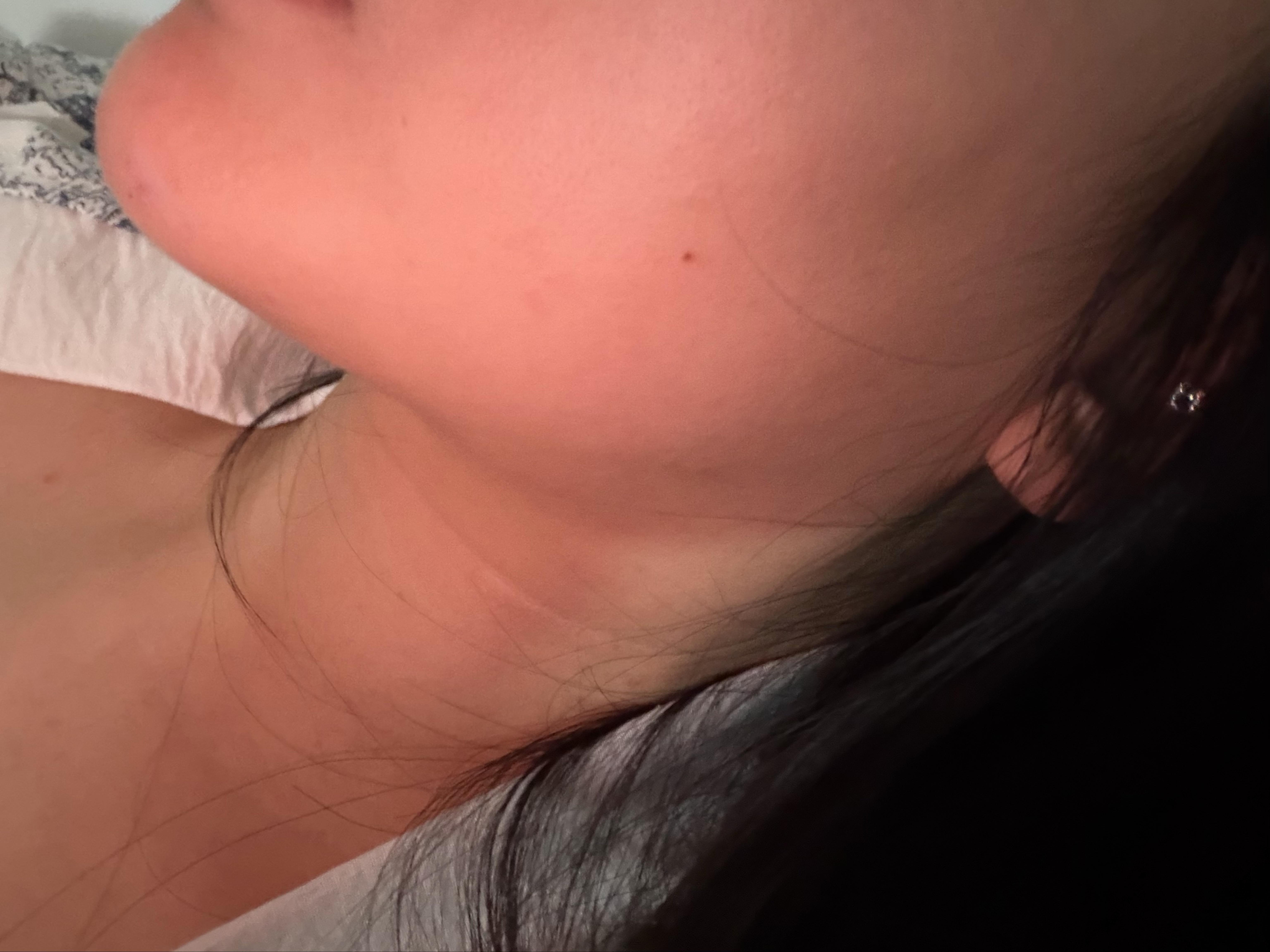 後