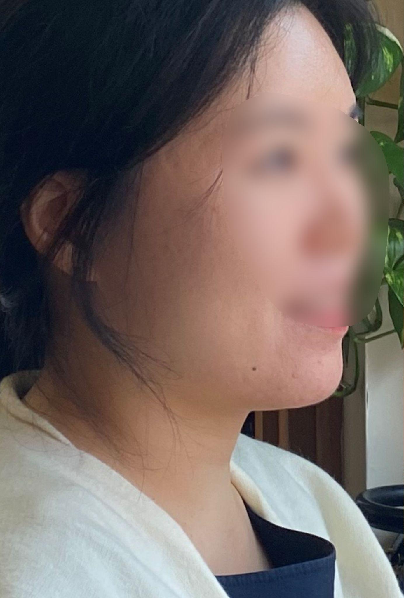 後