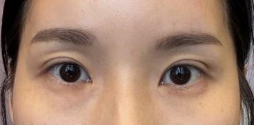 後
