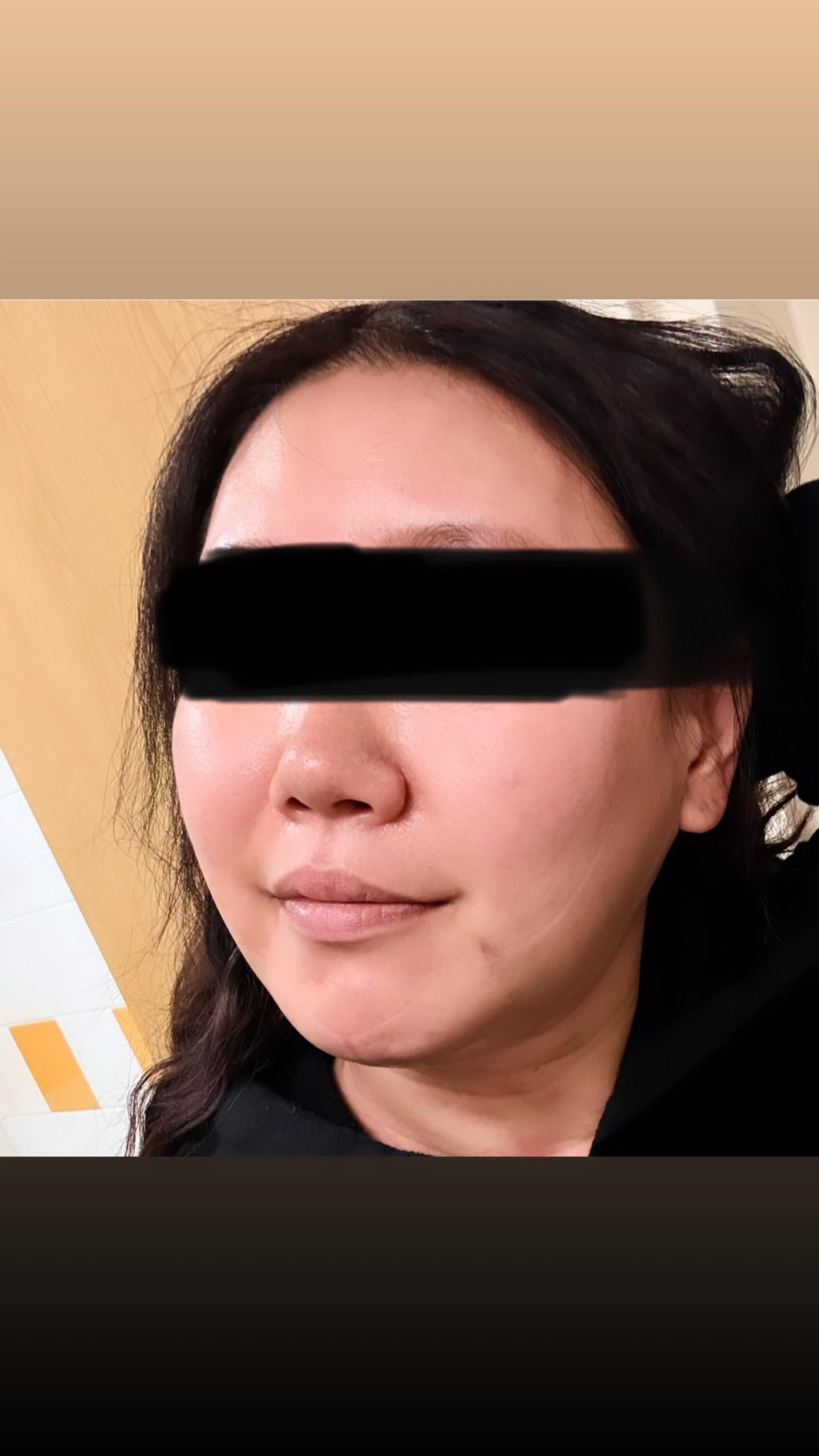 後