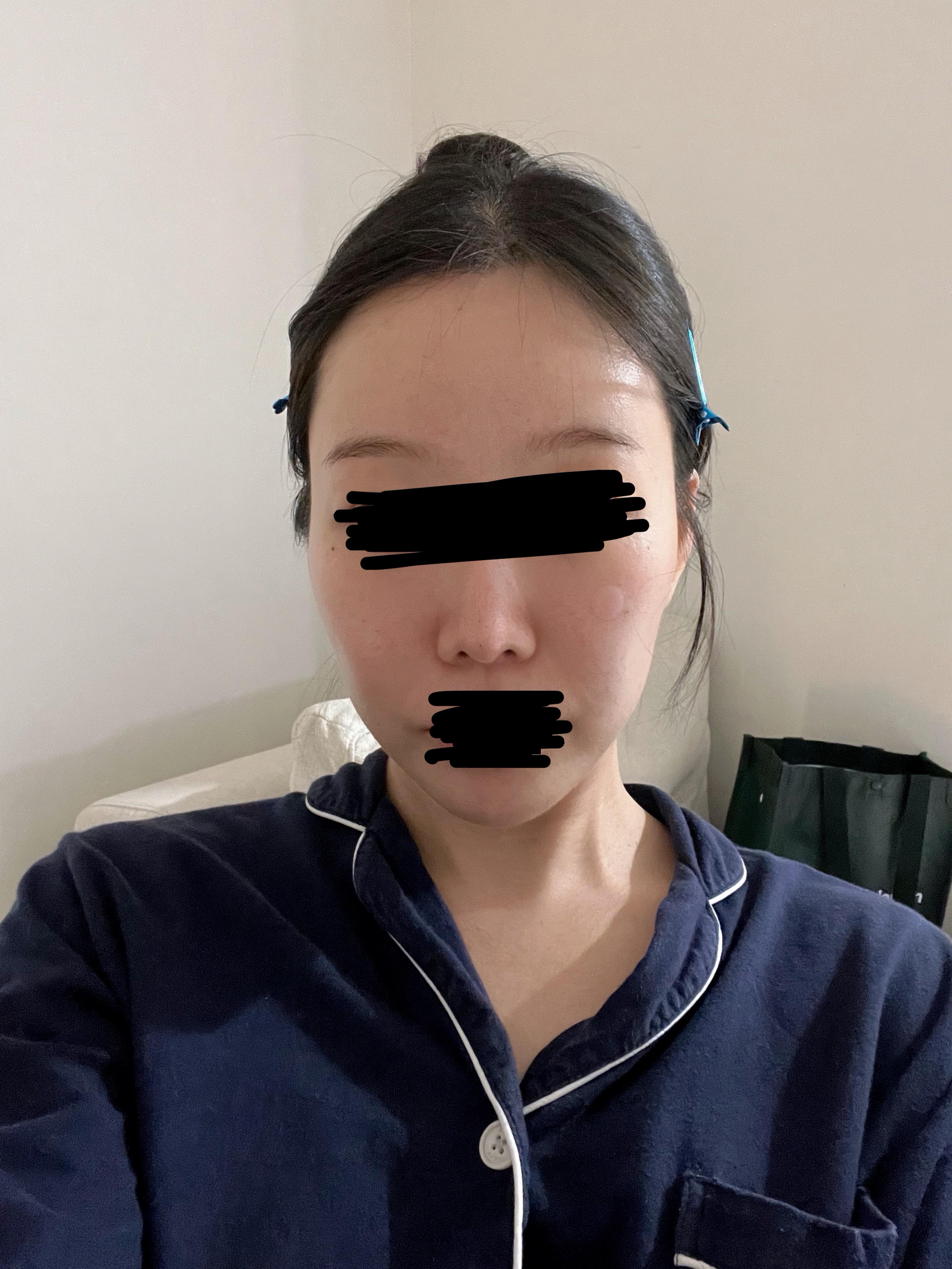 後