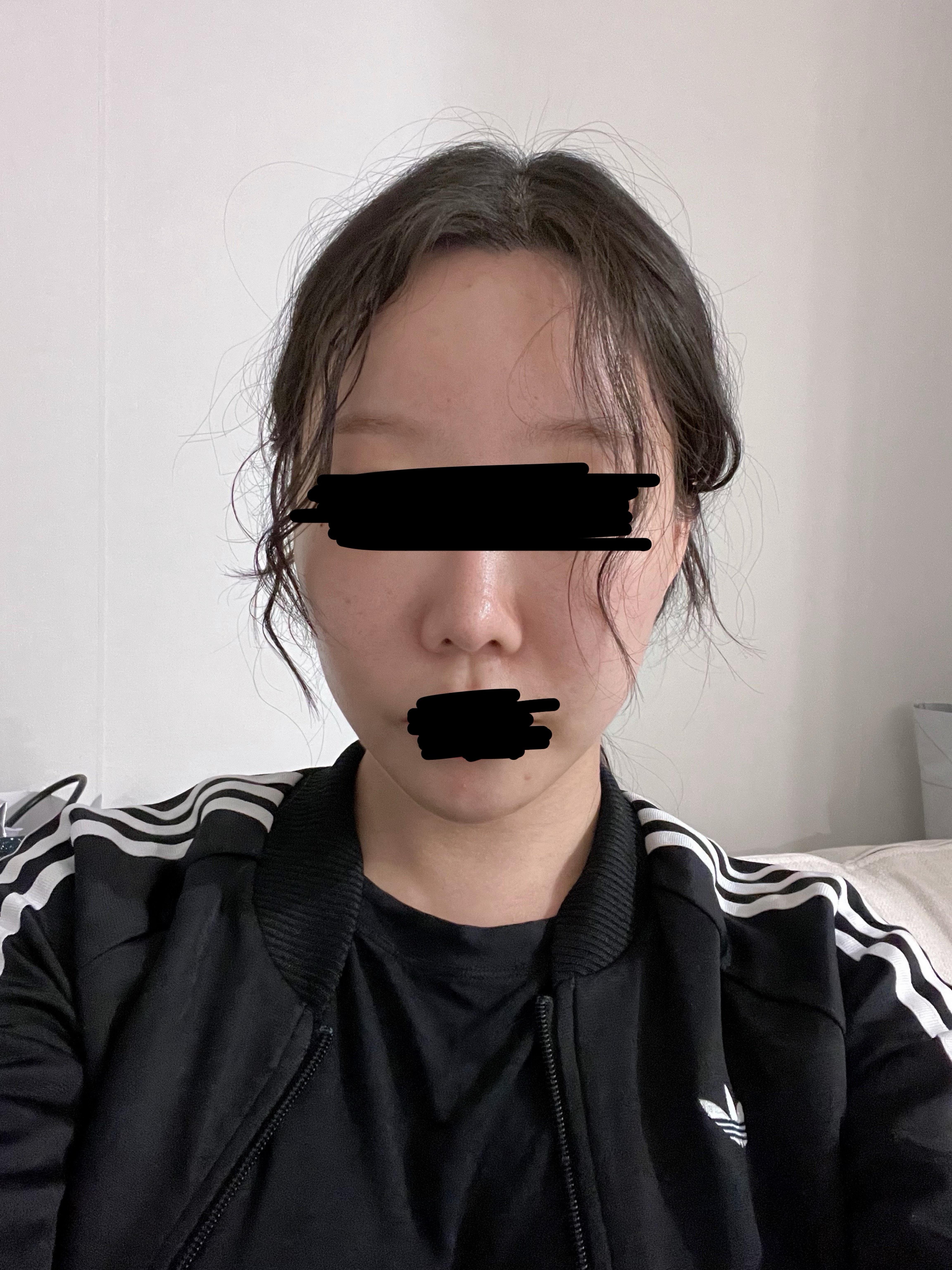 後