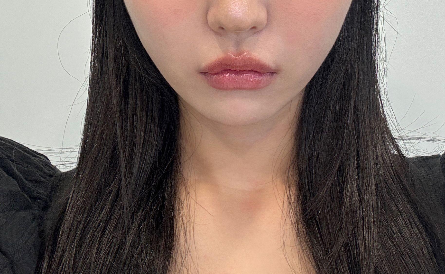 後