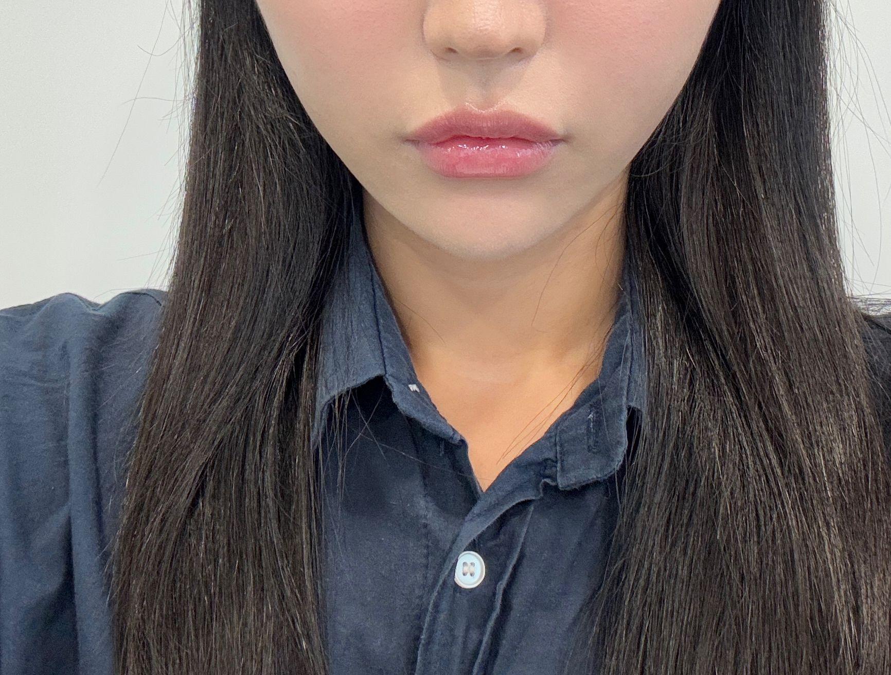 後