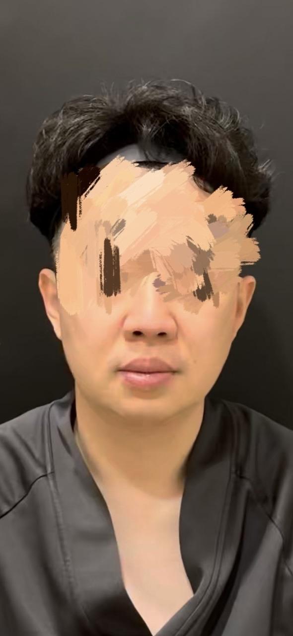 後