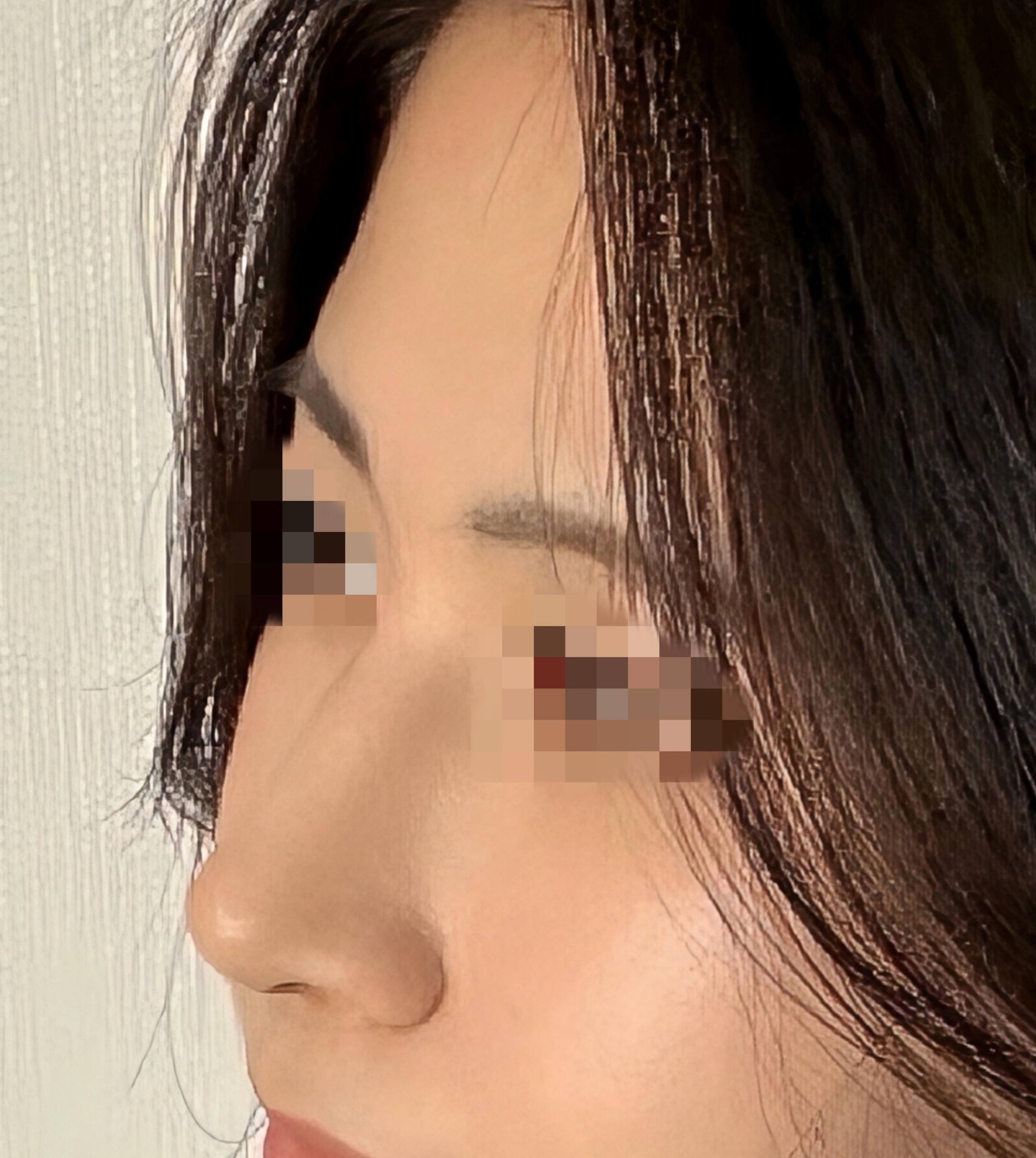 後