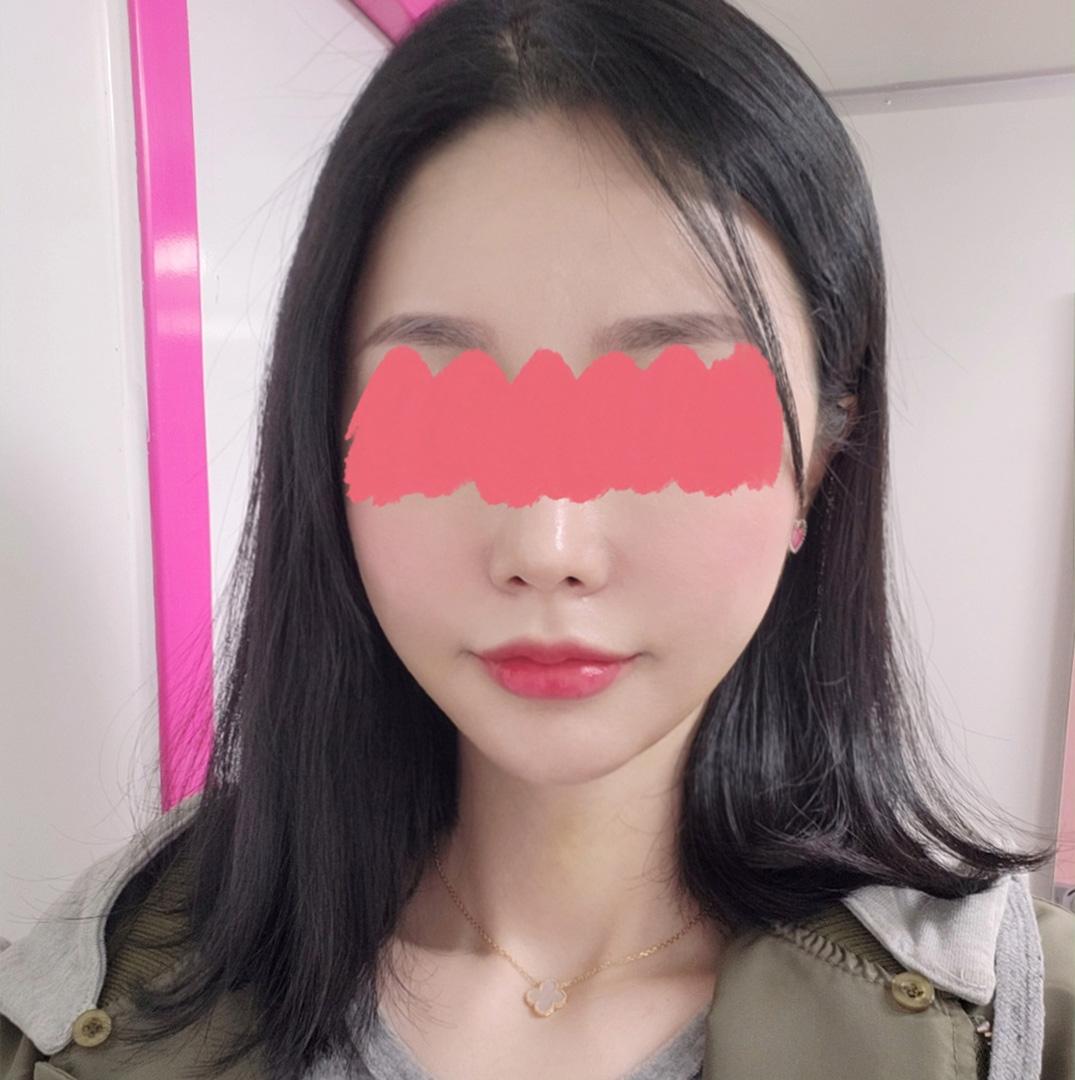 後