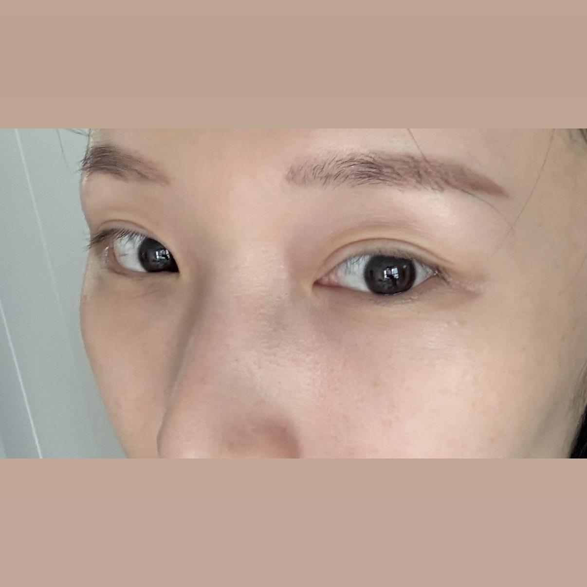 後