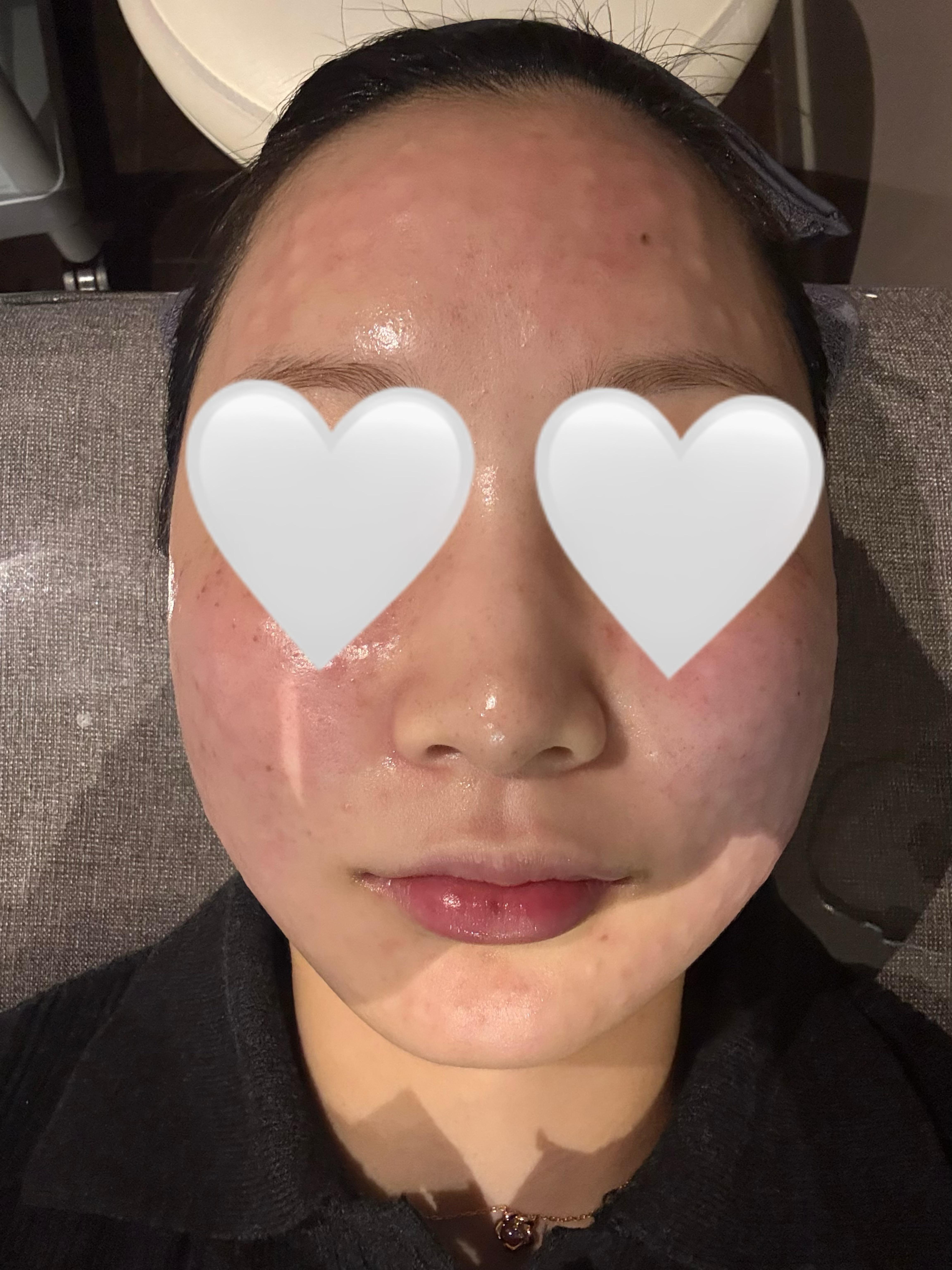 後