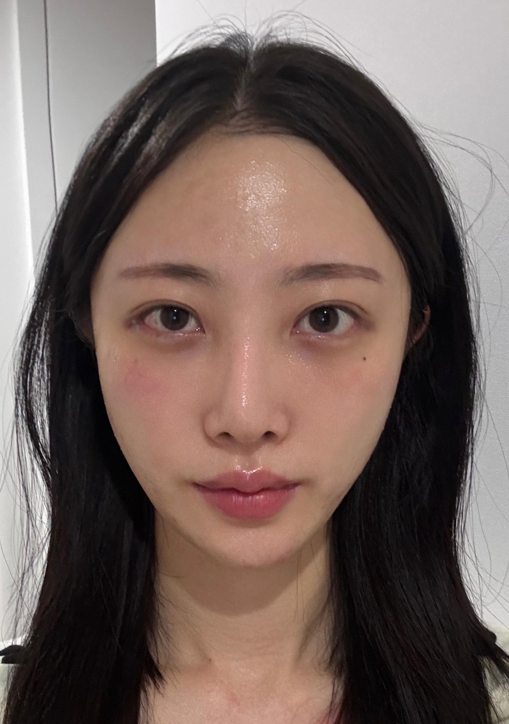 後