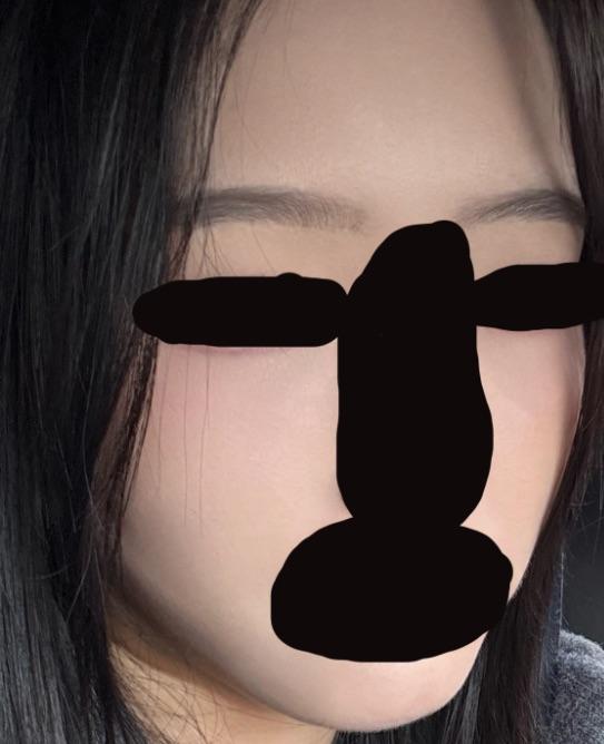 後
