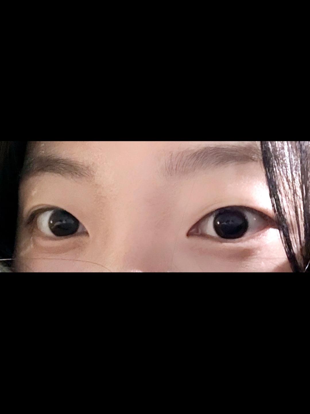 後