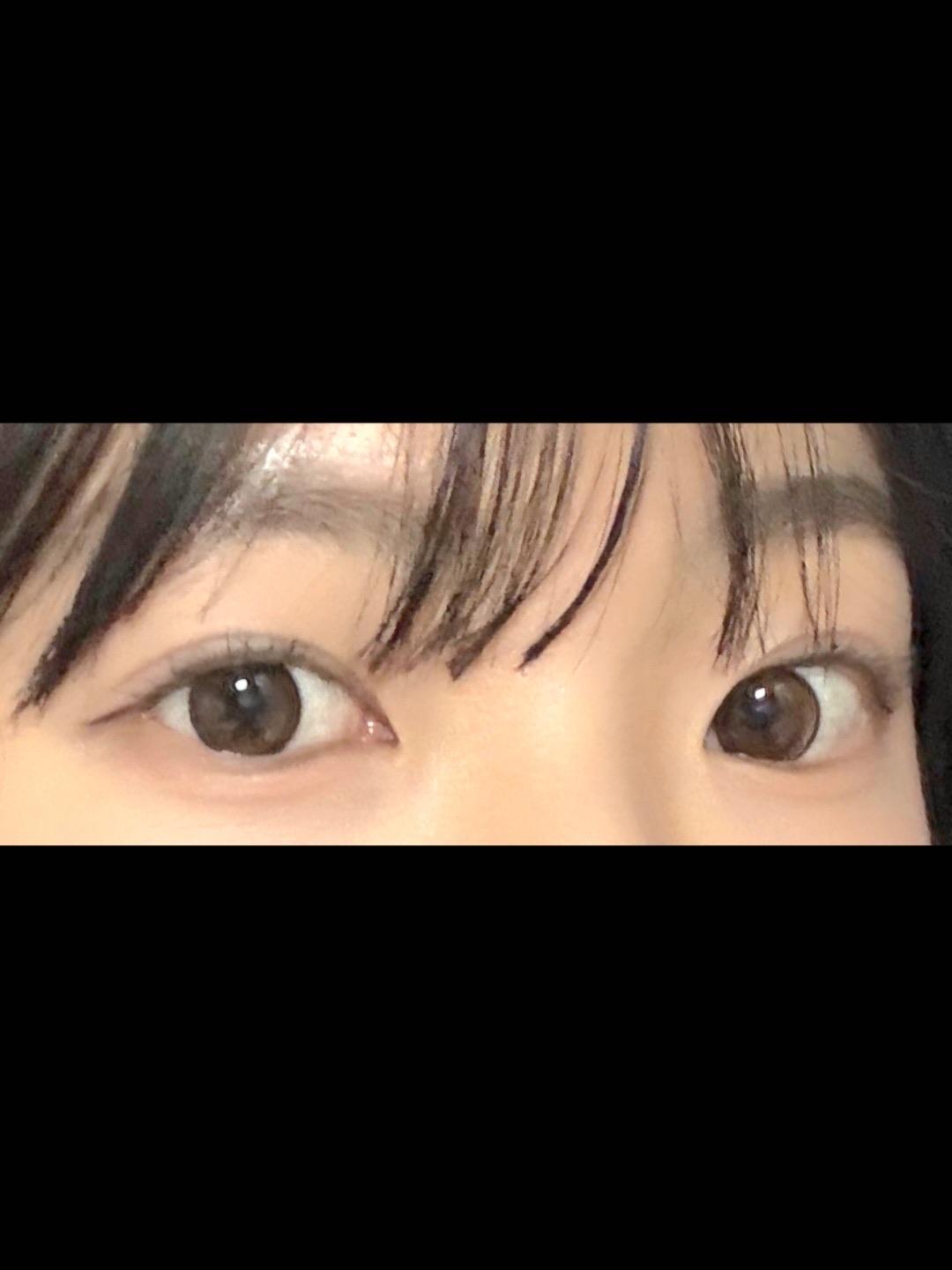後