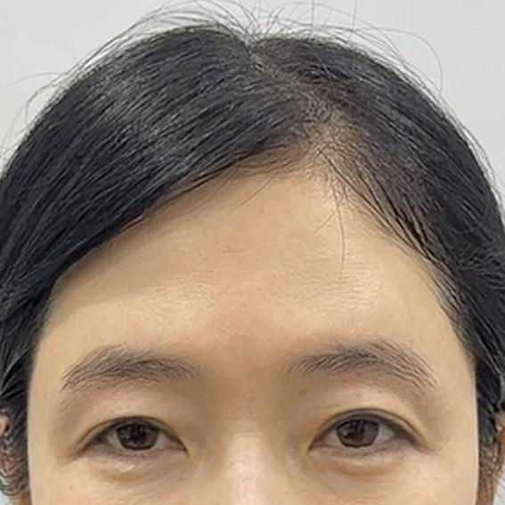 後