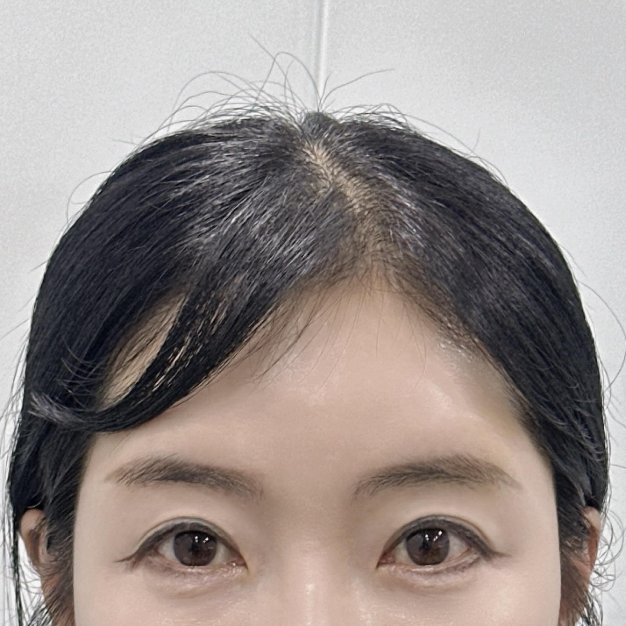 後