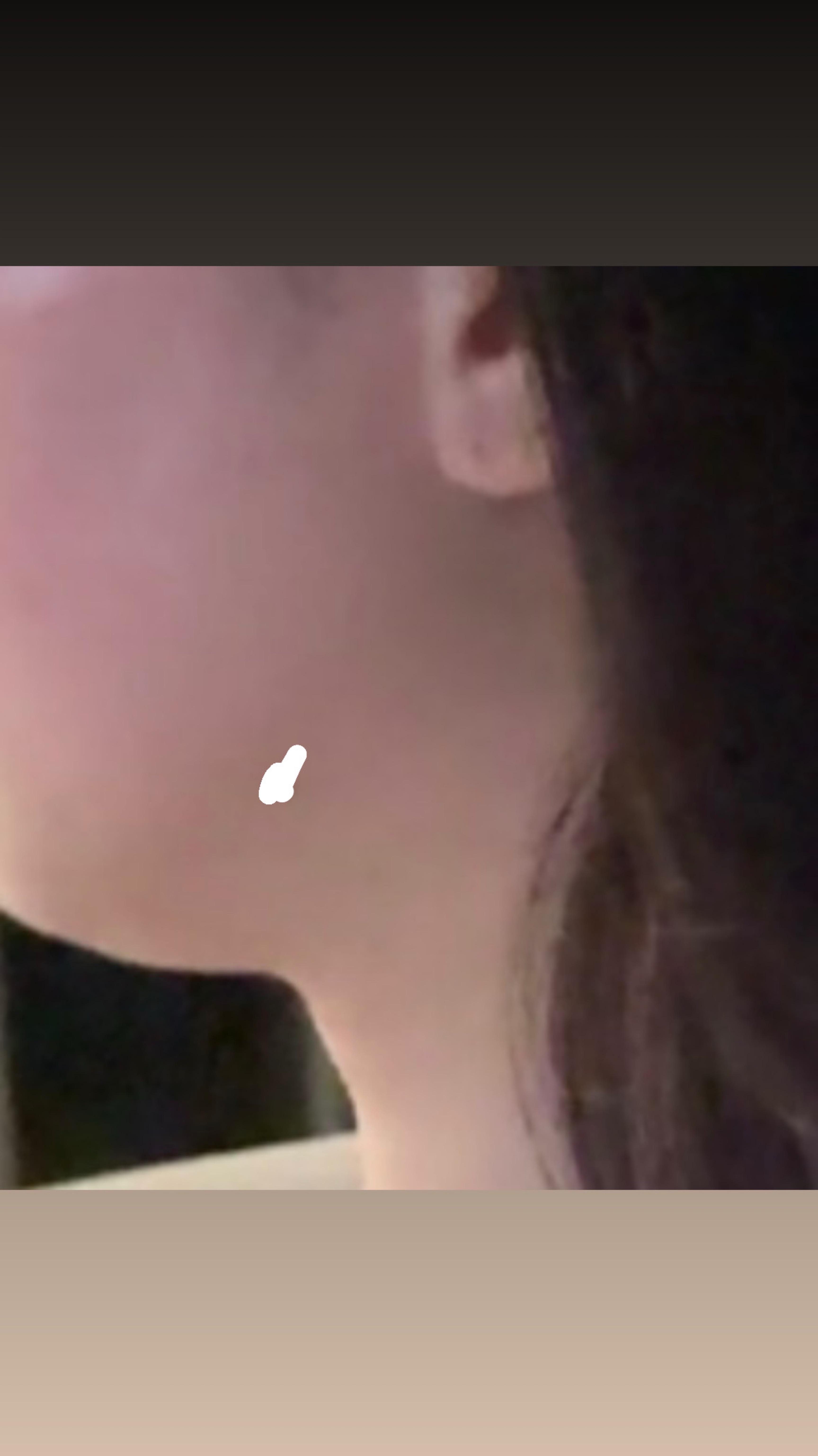 後