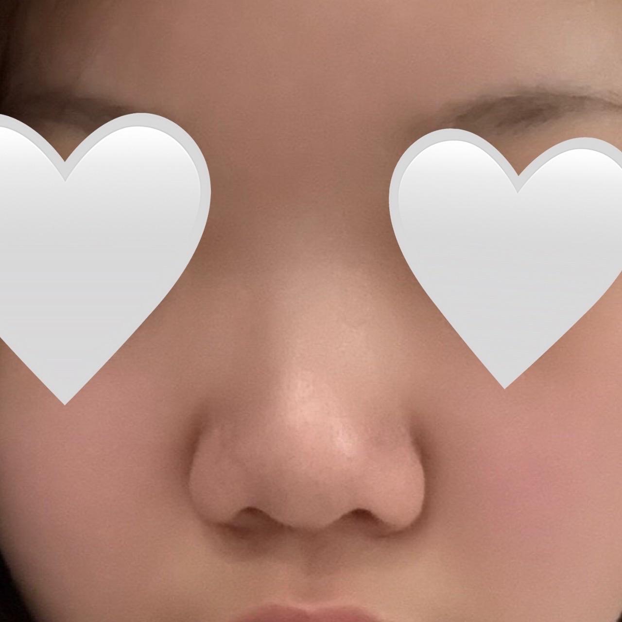 後