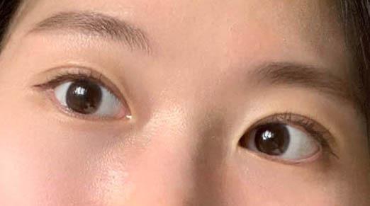 後