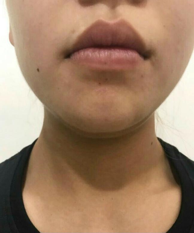 後