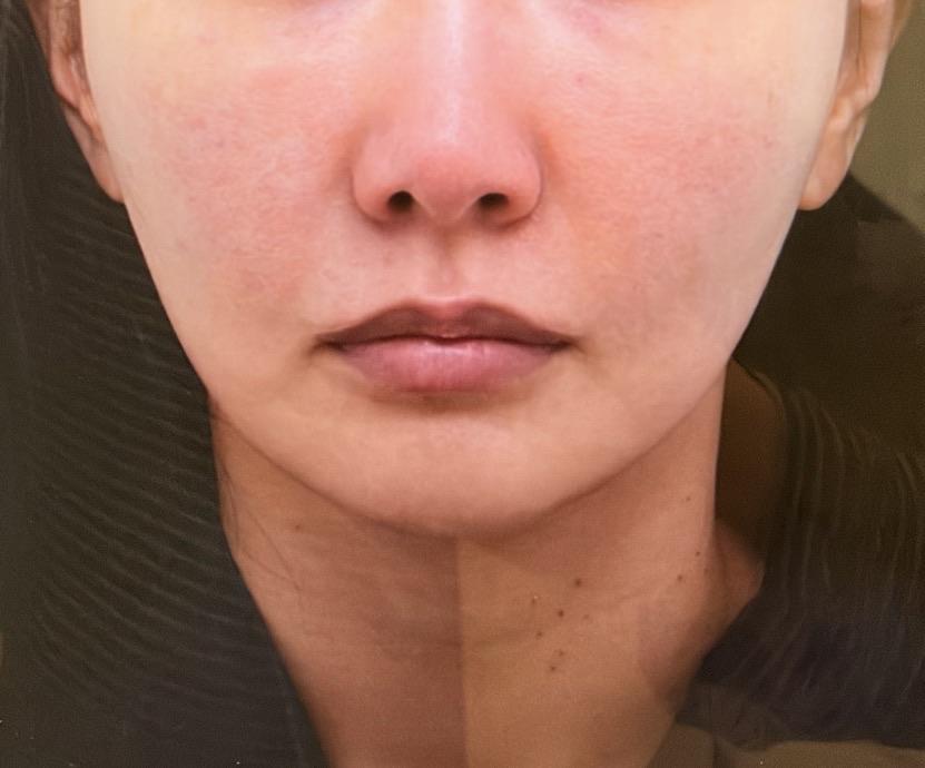 後