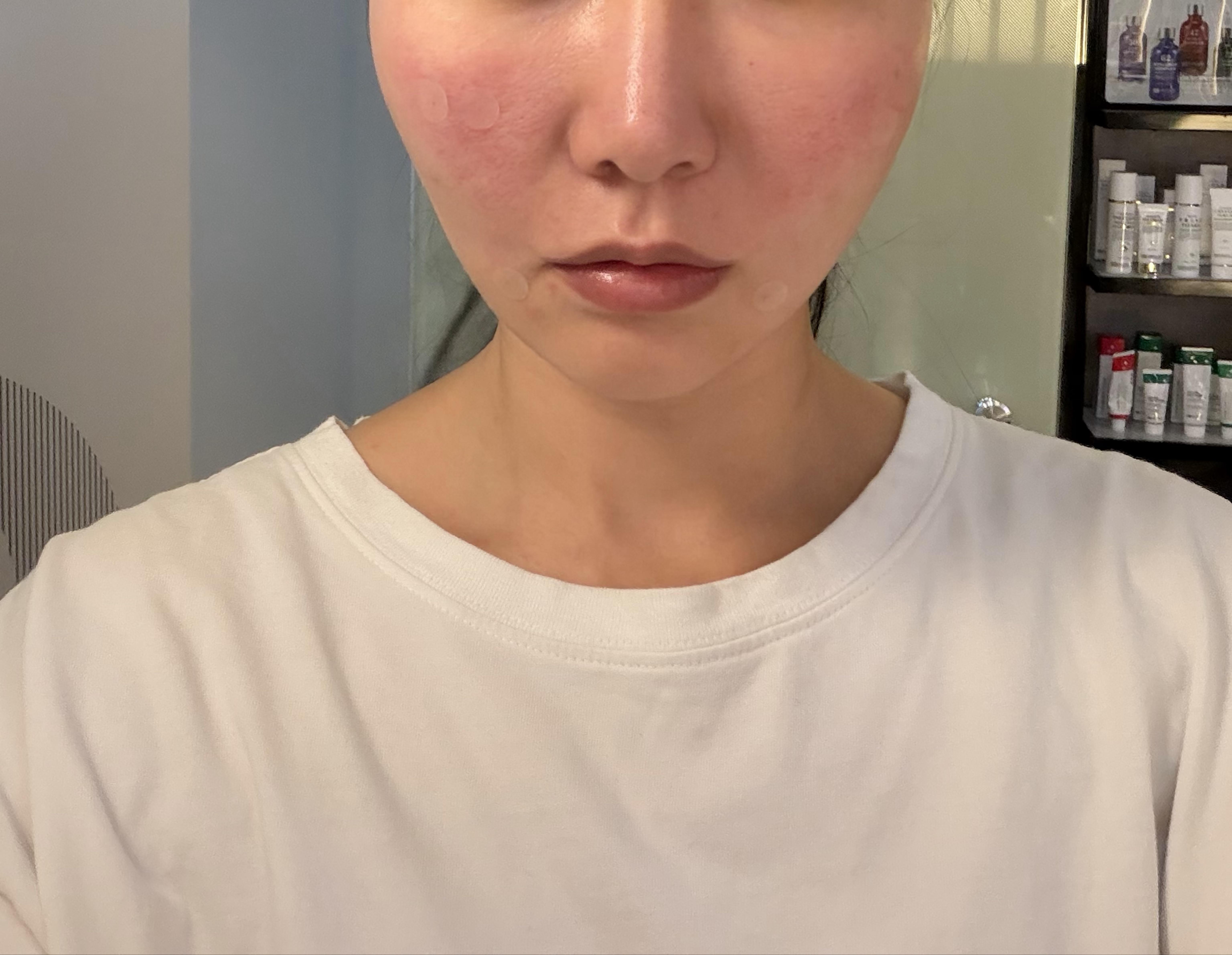 後