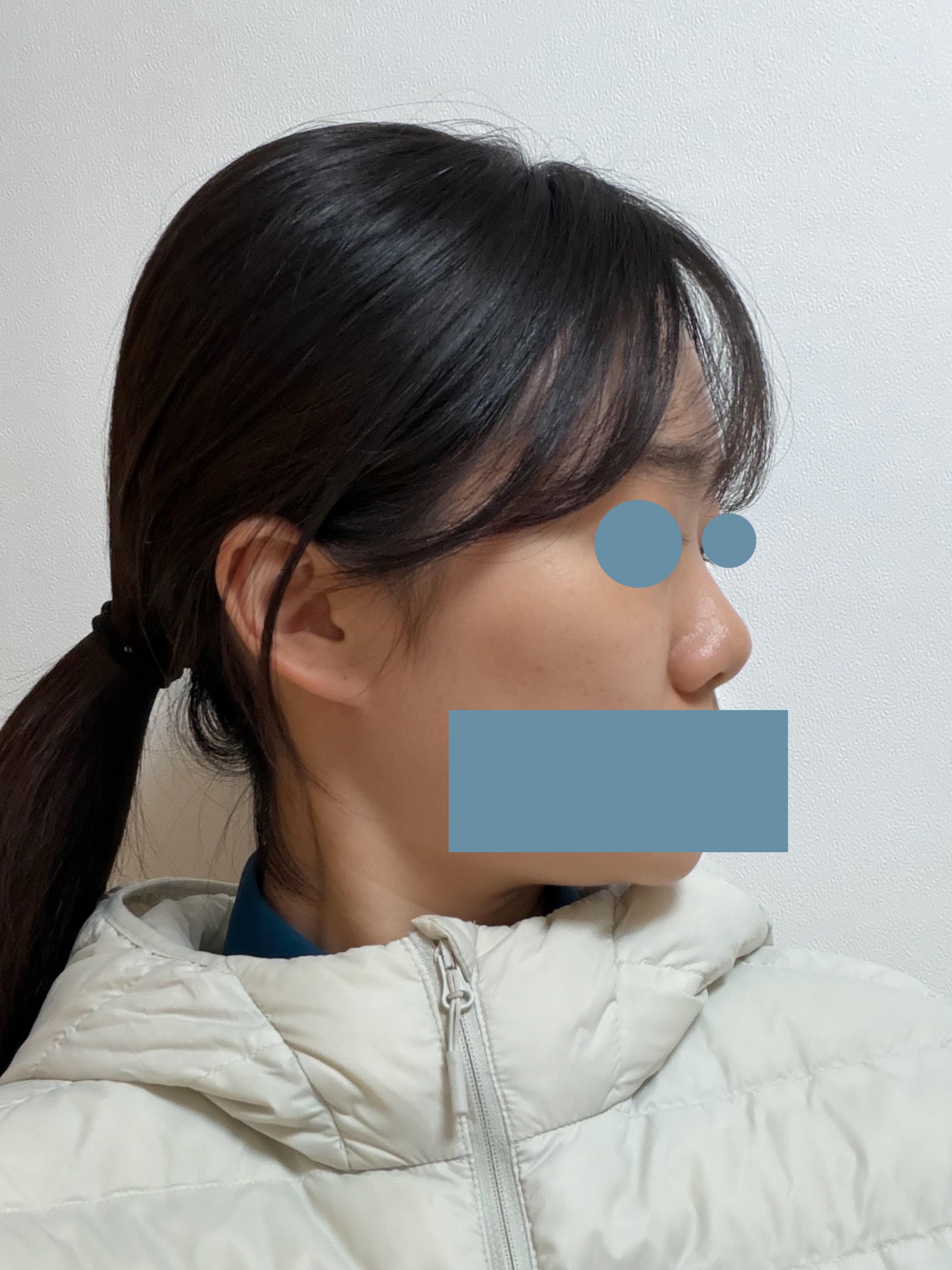 後