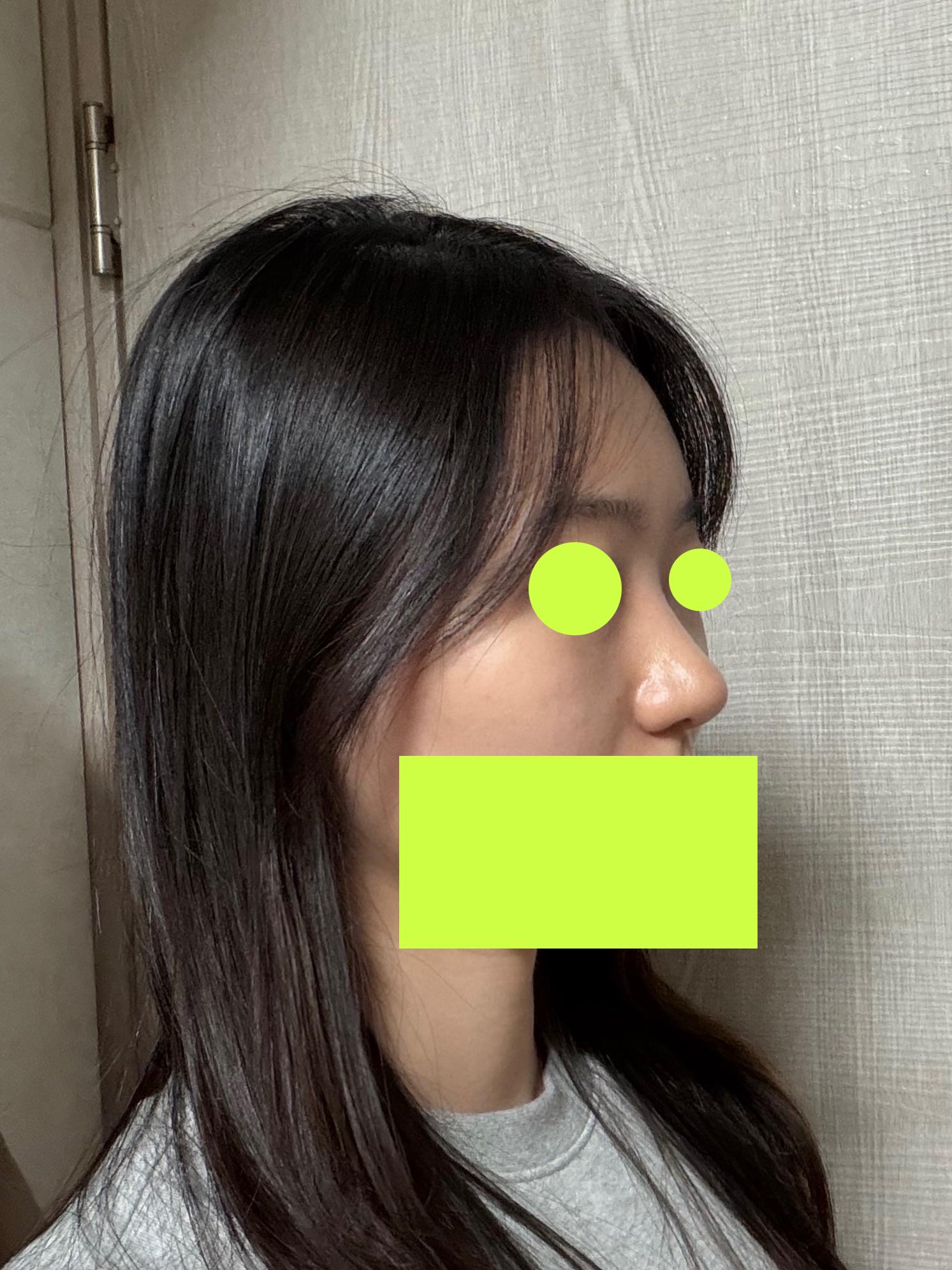 後