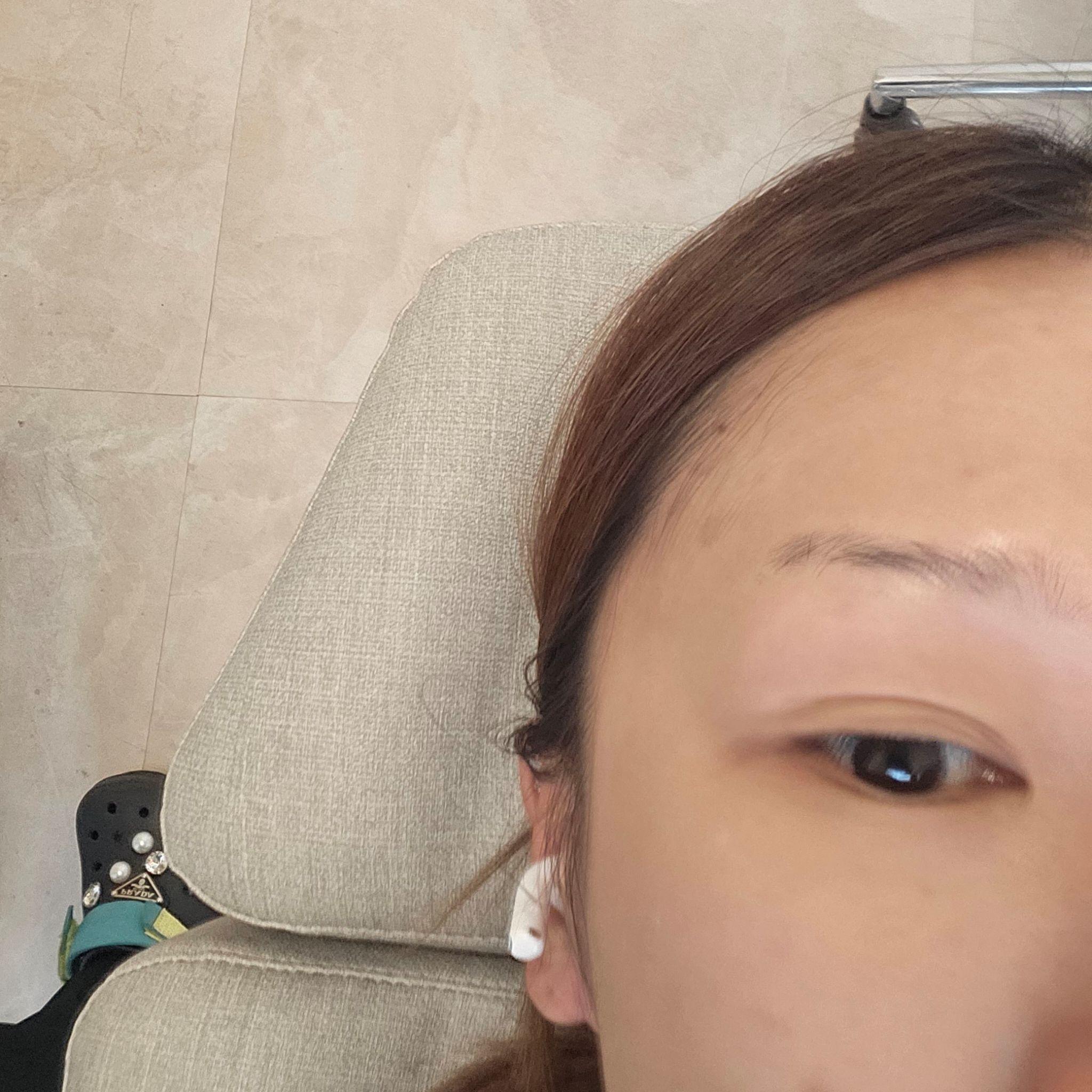 後