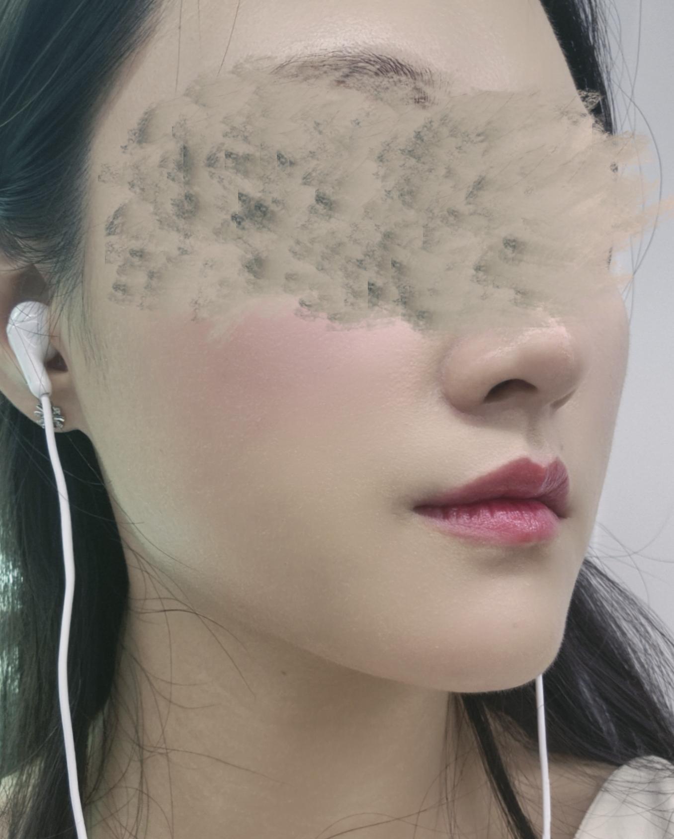後