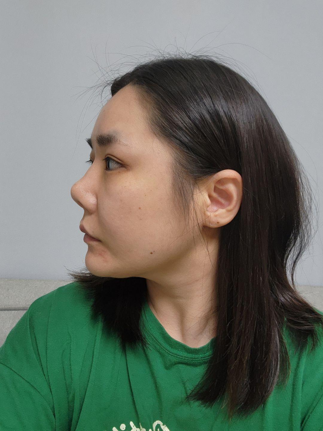 後