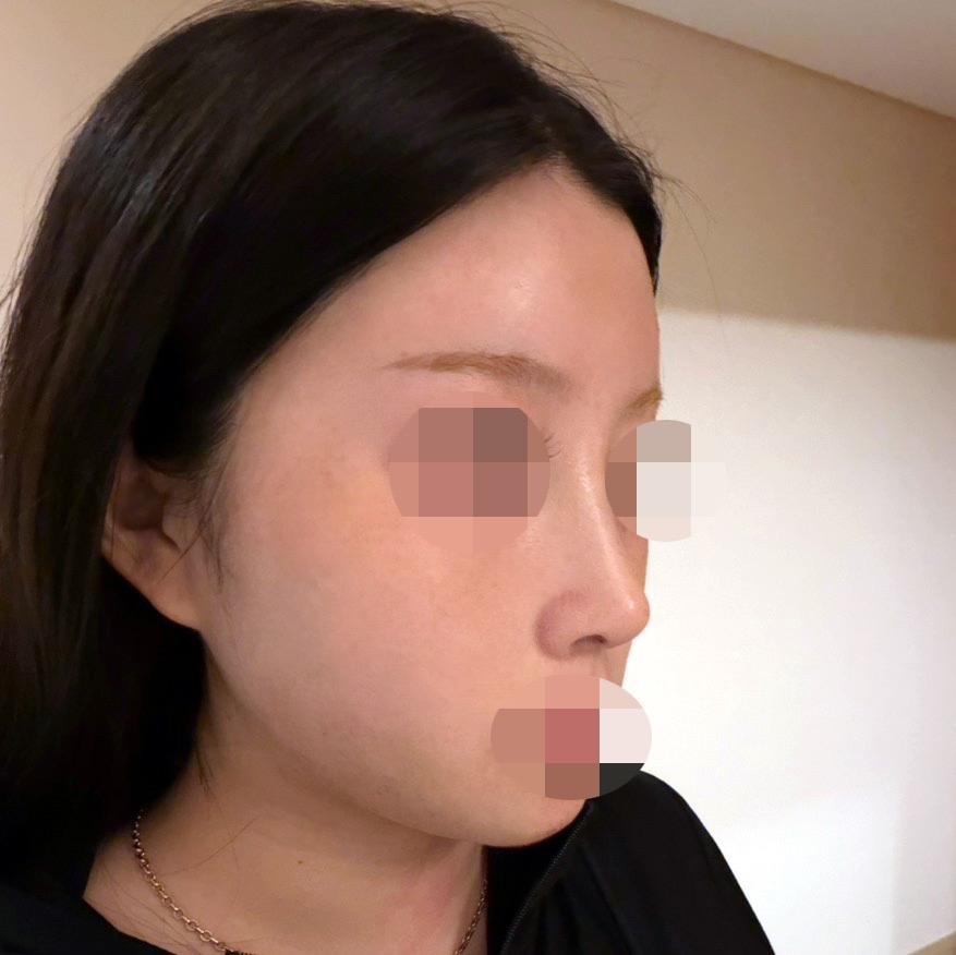 後