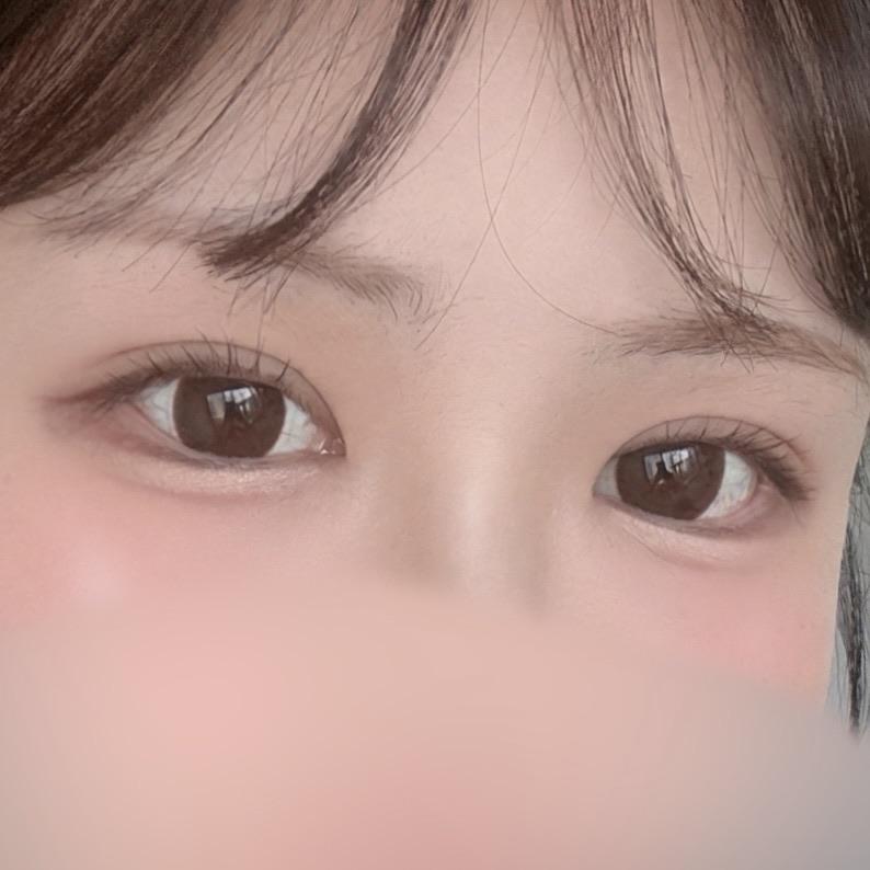 後