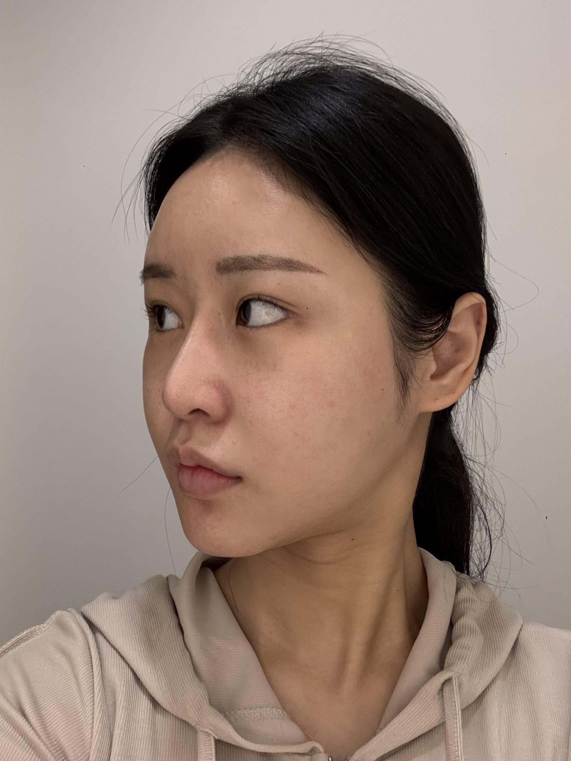 後