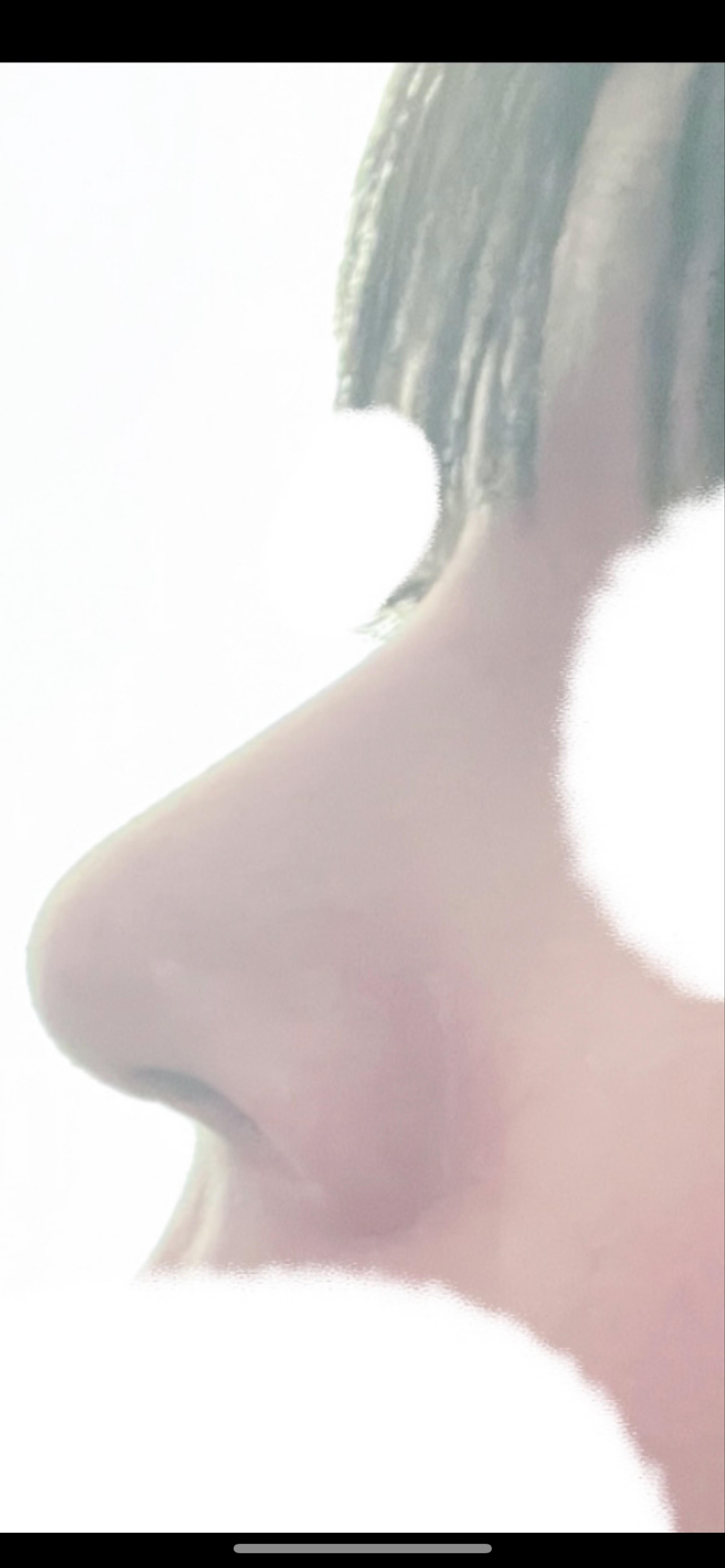 後