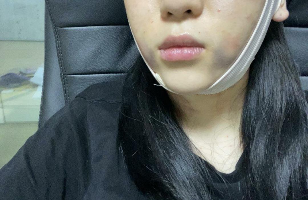 後