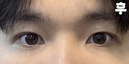 後