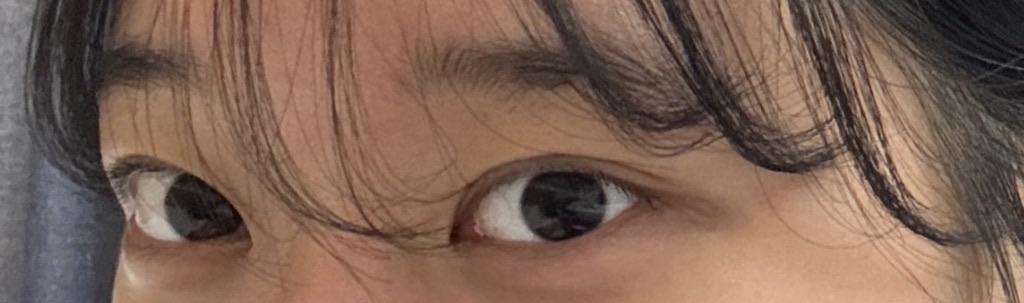 後