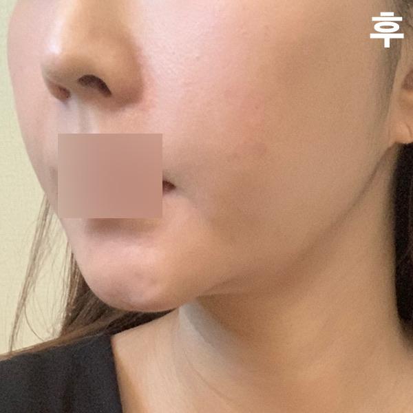 後