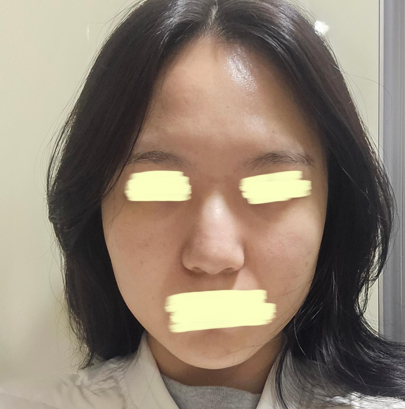 後